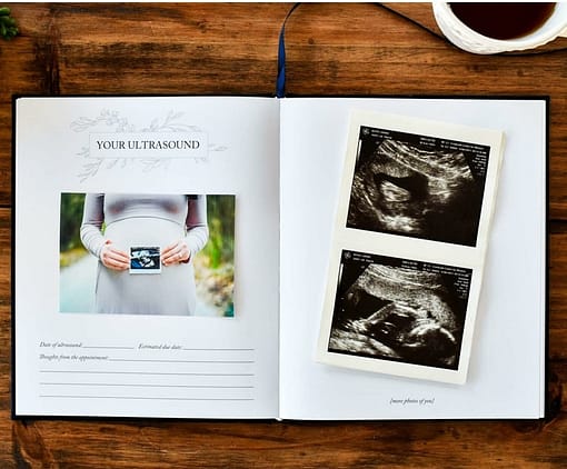 Pregnancy Prayer Journal